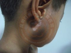 ��ͯ�������ԭ������Щ��